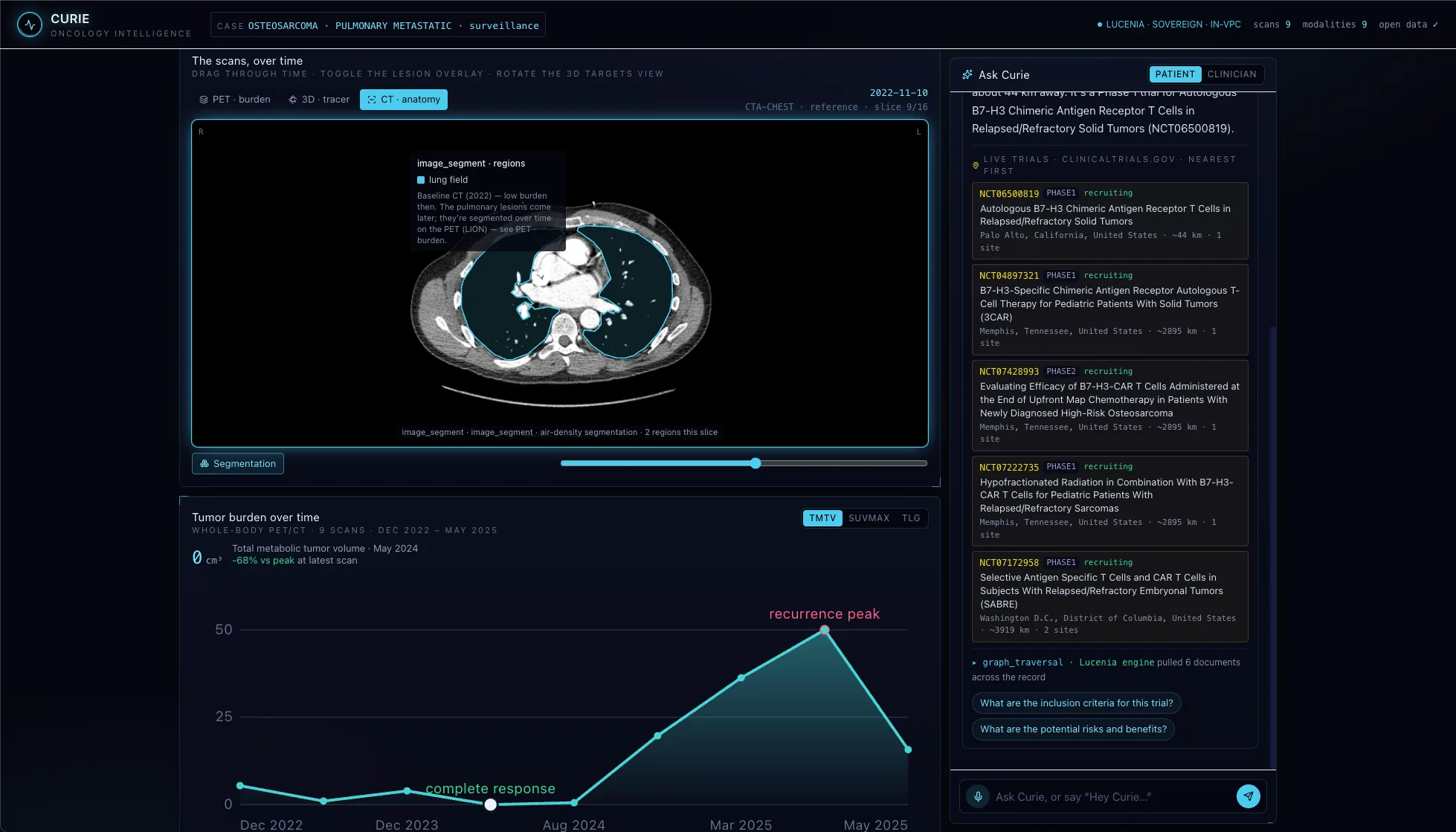 CURIE oncology intelligence